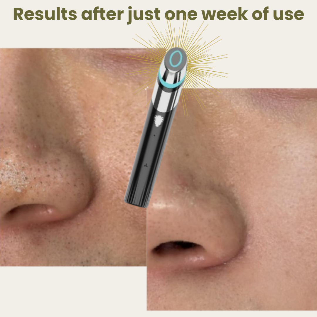 Anti Aging SKIN-R Booster PRO - Skin Glam Tech™