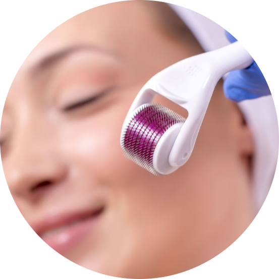 Microneedling