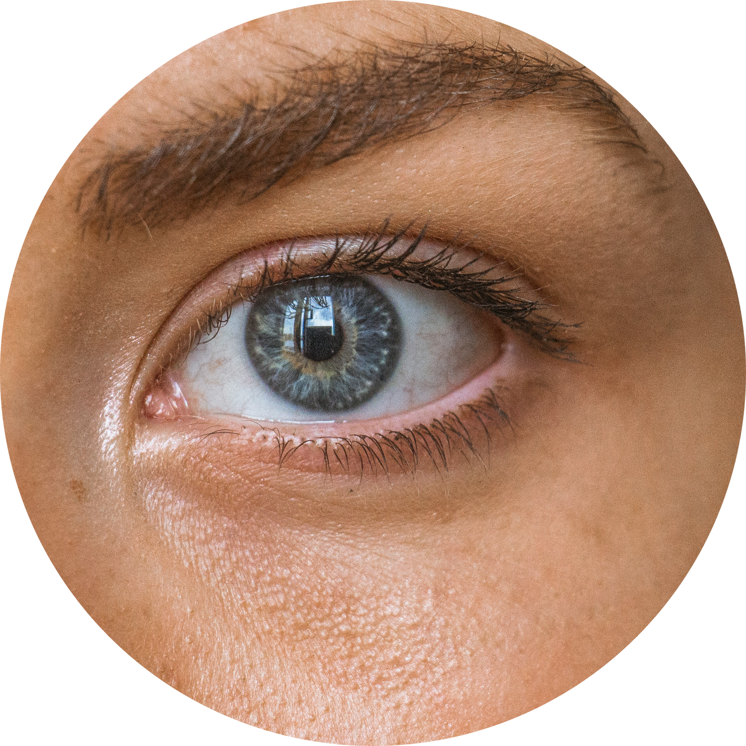 Dark Circles & Under-Eye Concerns